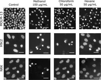 Evaluation of the cytotoxic and antimicrobial potential of epiphytic biomass obtained from Laminaria hyperborea biorefinery side-streams